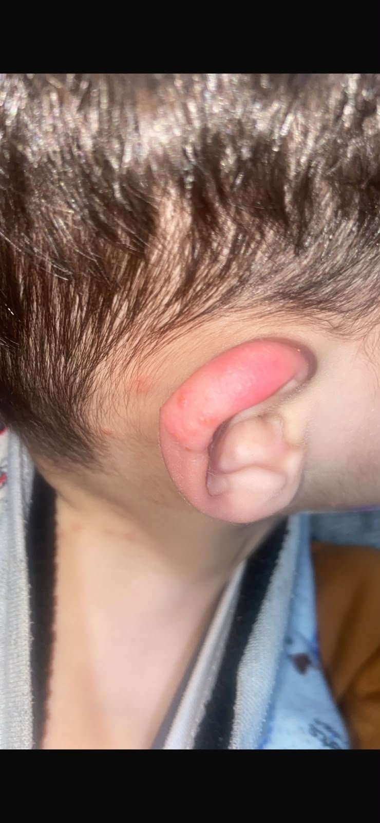 Help Nasser Get Treatment for Skin Disease and Start School campaign photo, 5 of 7