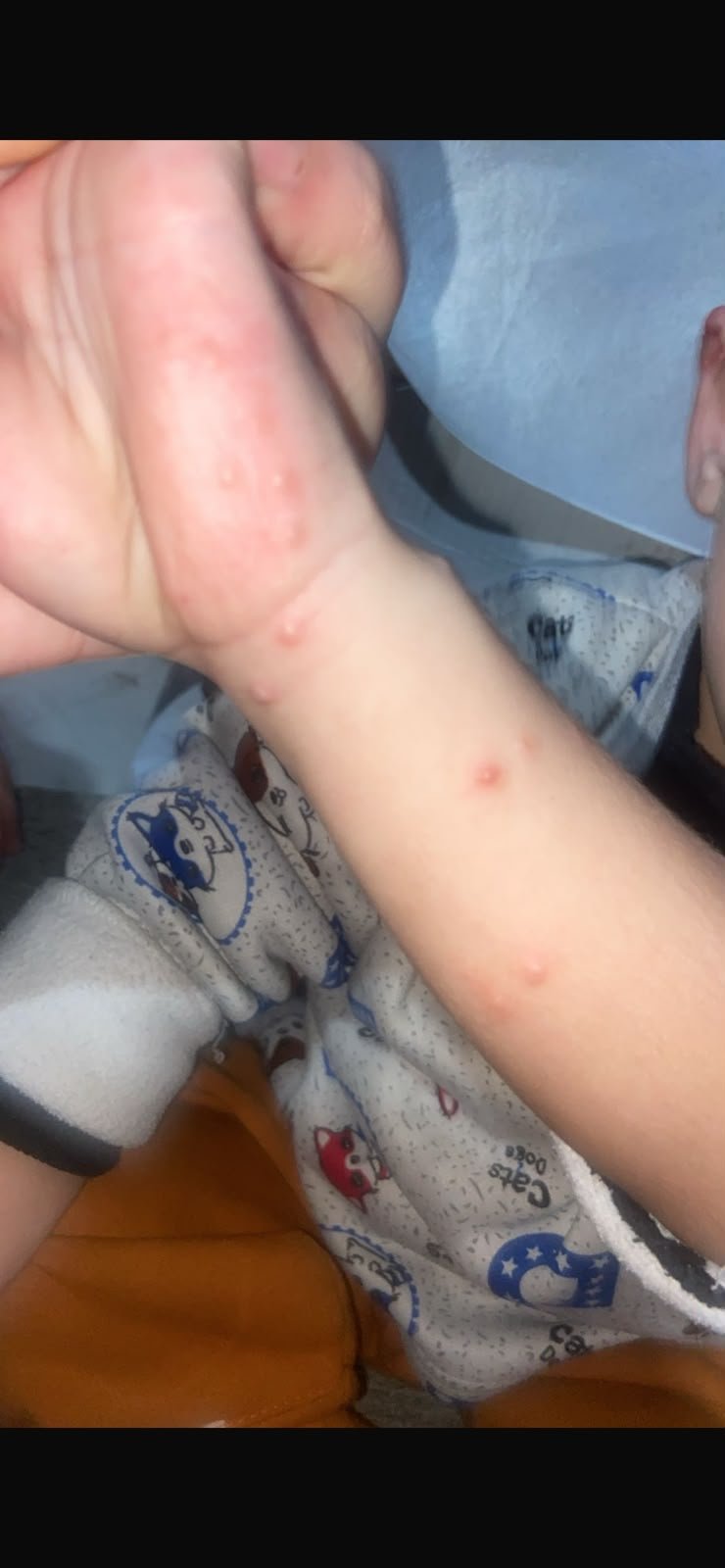 Help Nasser Get Treatment for Skin Disease and Start School campaign photo, 6 of 7