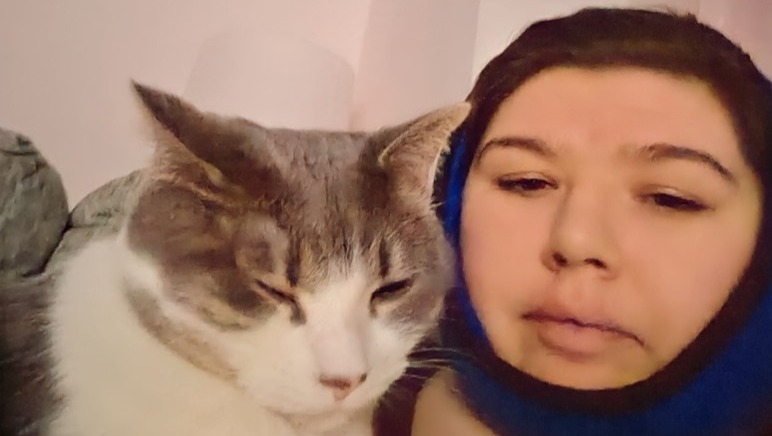 Fundraiser for Lindsay Tekler by Emily Nelson : Support Lindsay's Jaw