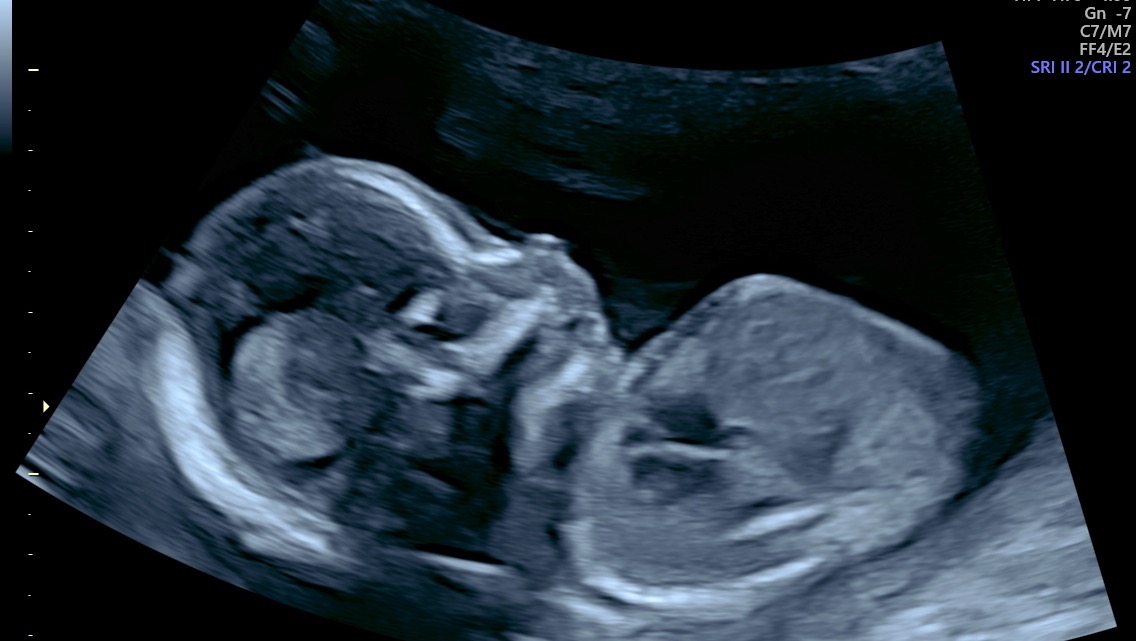 Hector Kururangi photo