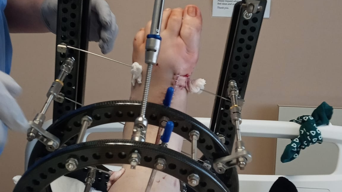 Help Support Shelbie While Recovering From Amputation photo