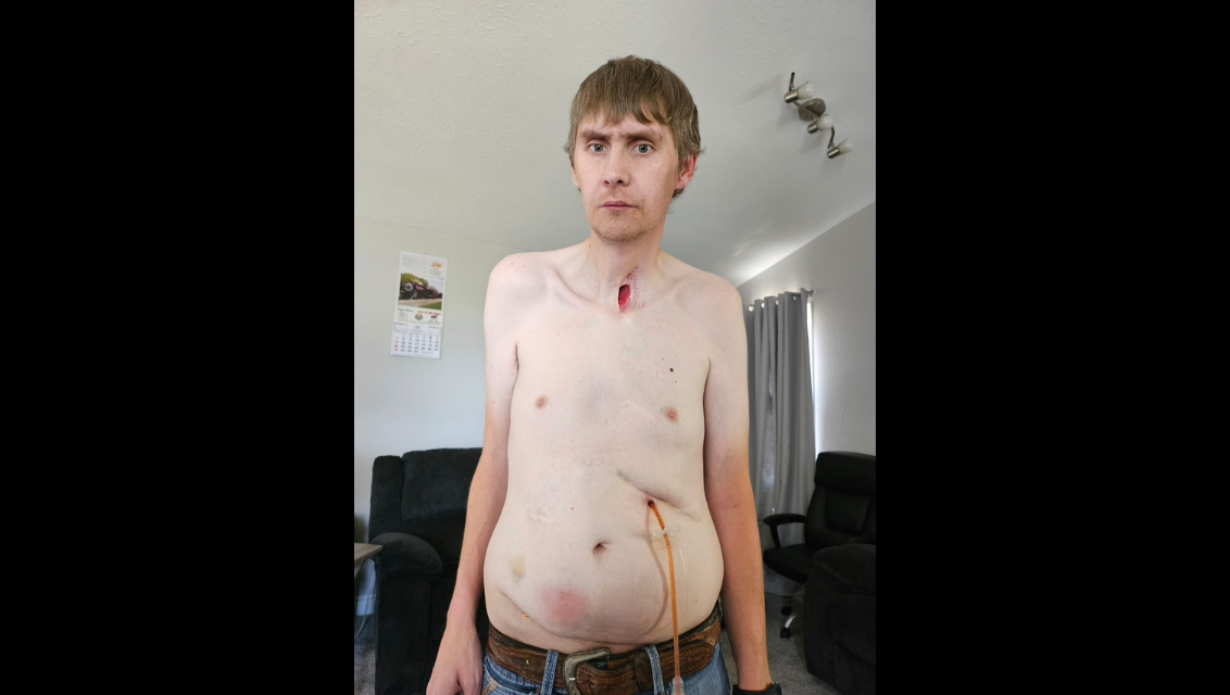 Help George Loewen get a much needed surgery photo