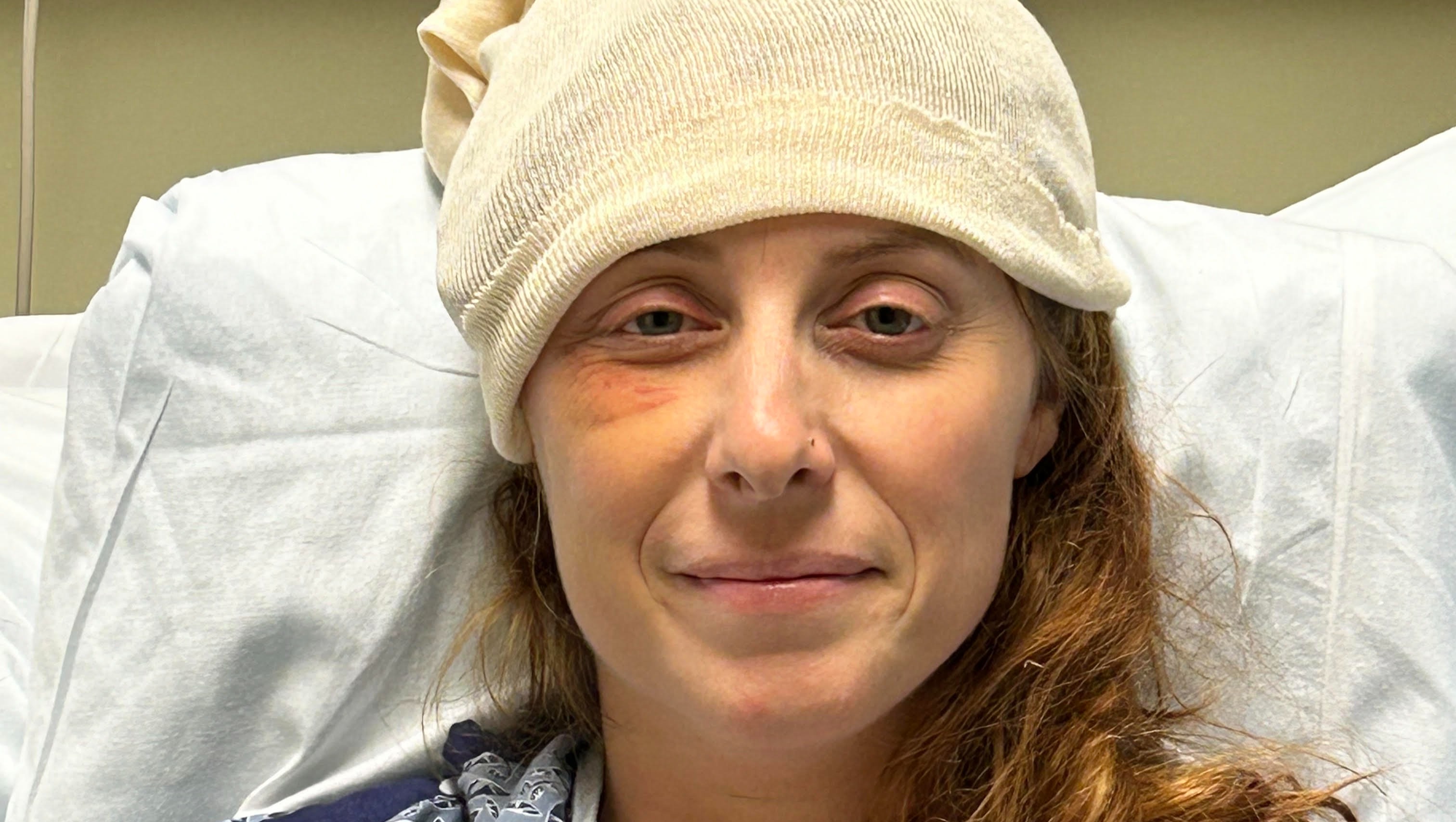 Sundeep Kaur'S Recovery: A Journey From Trauma To Triumph - be6ih6y