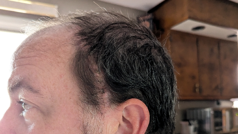 Ryan Gullett's brain cancer fundraiser photo