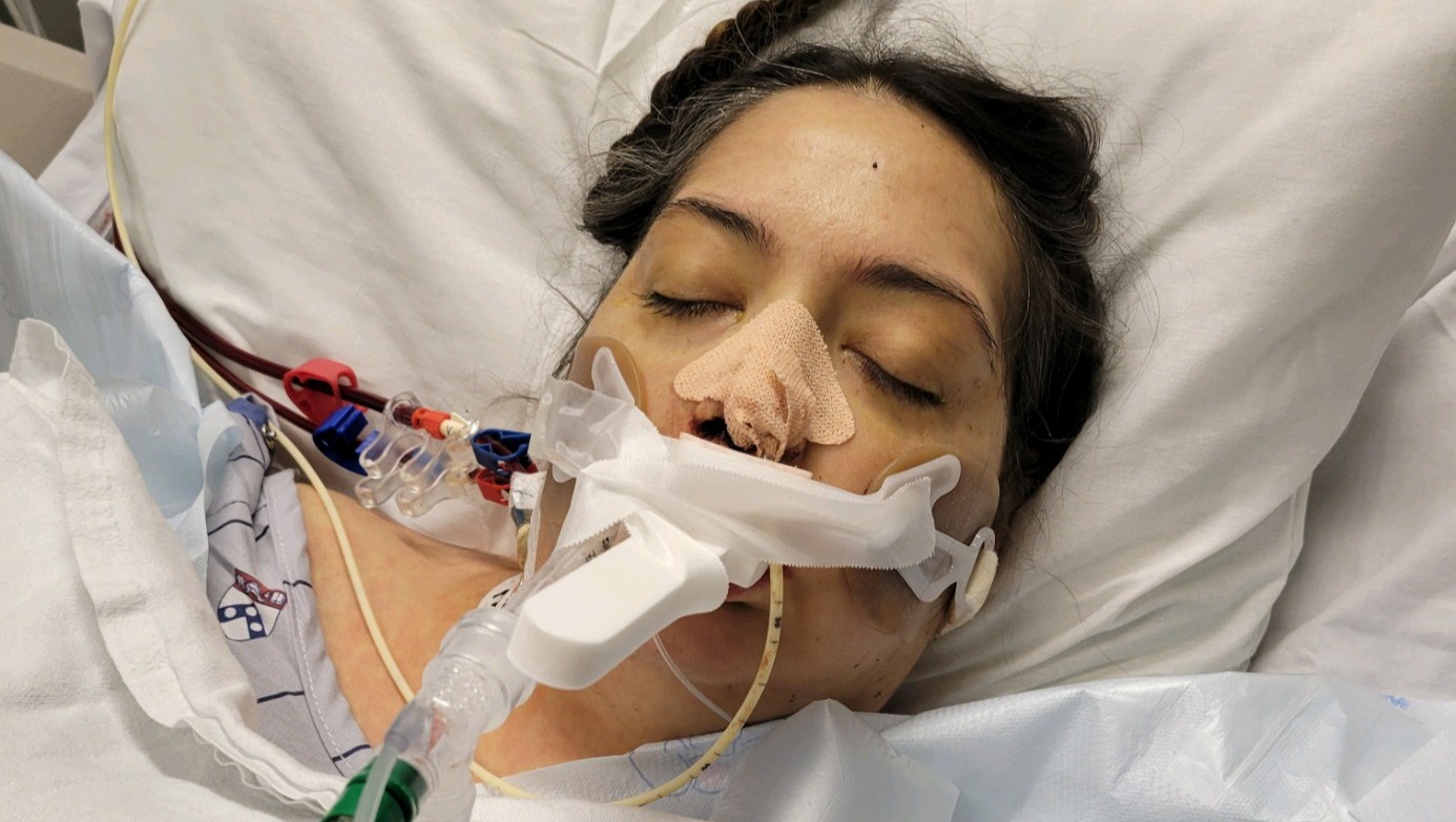 Fundraiser by Annette Rowe : Support Emily Teed's Life-Saving Liver ...