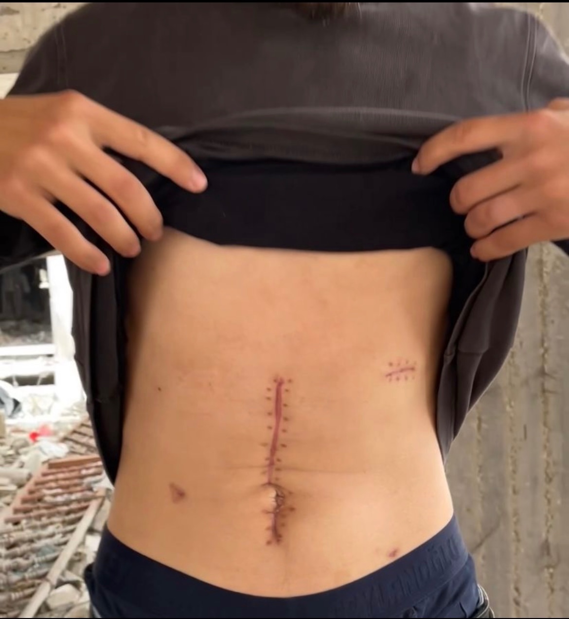 Help Abood in Gaza Escape Starvation and Bombings campaign photo, 7 of 8