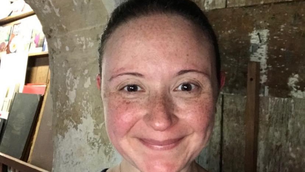 Elizabeth’s Giumetti’s  battle with cancer. photo