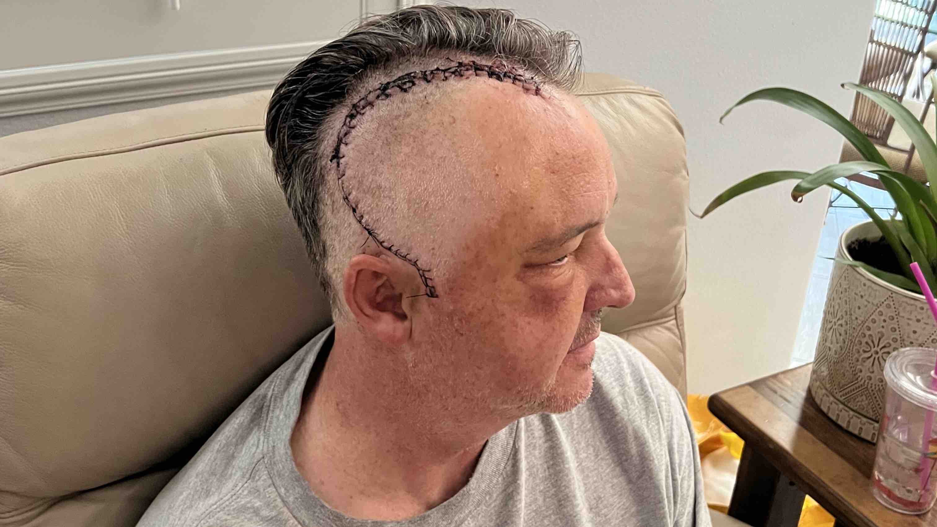 Dana’s Brain Tumor Recovery photo