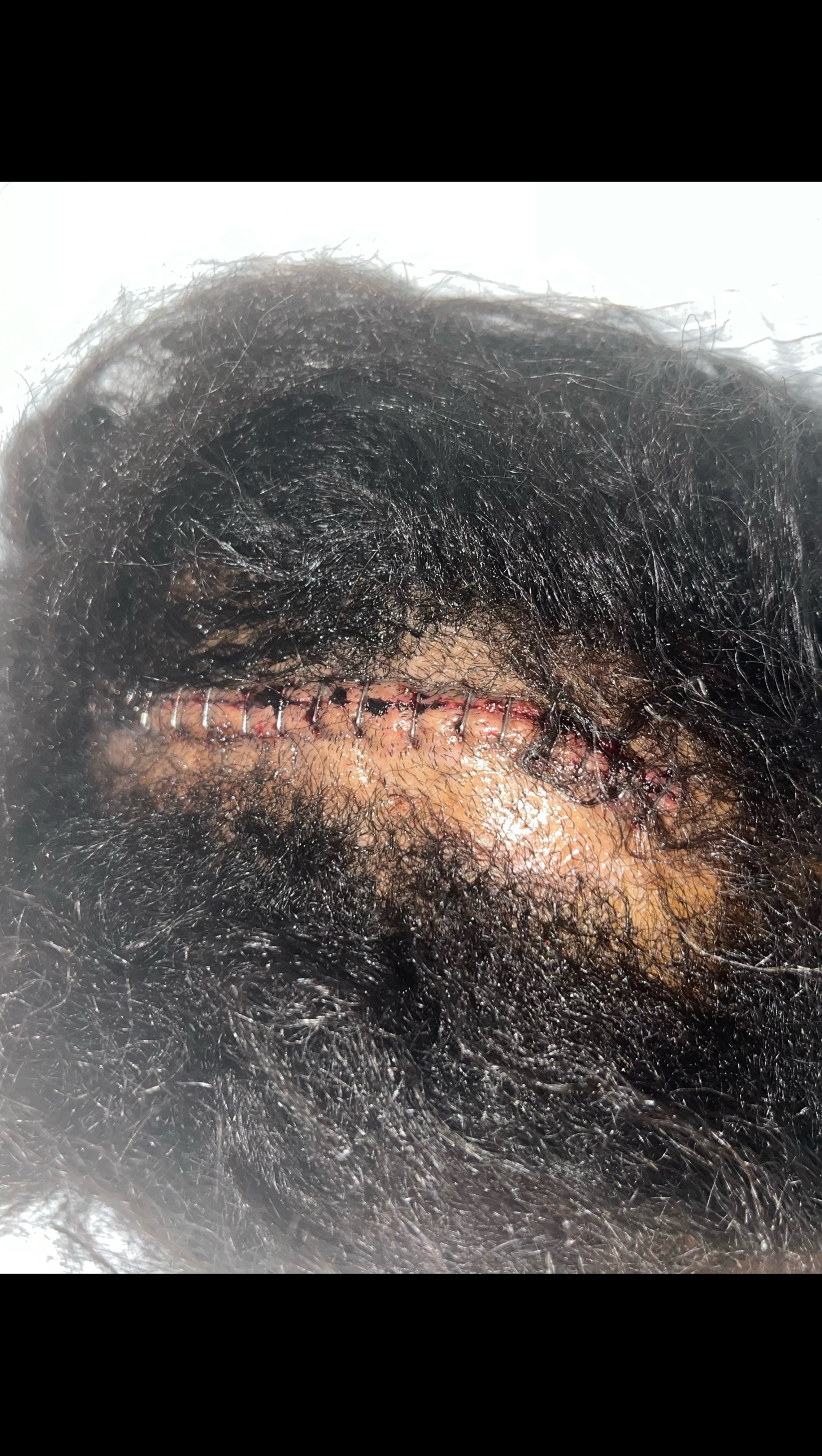 Fundraiser by Monica Williams Racquel’s Road to Recovery