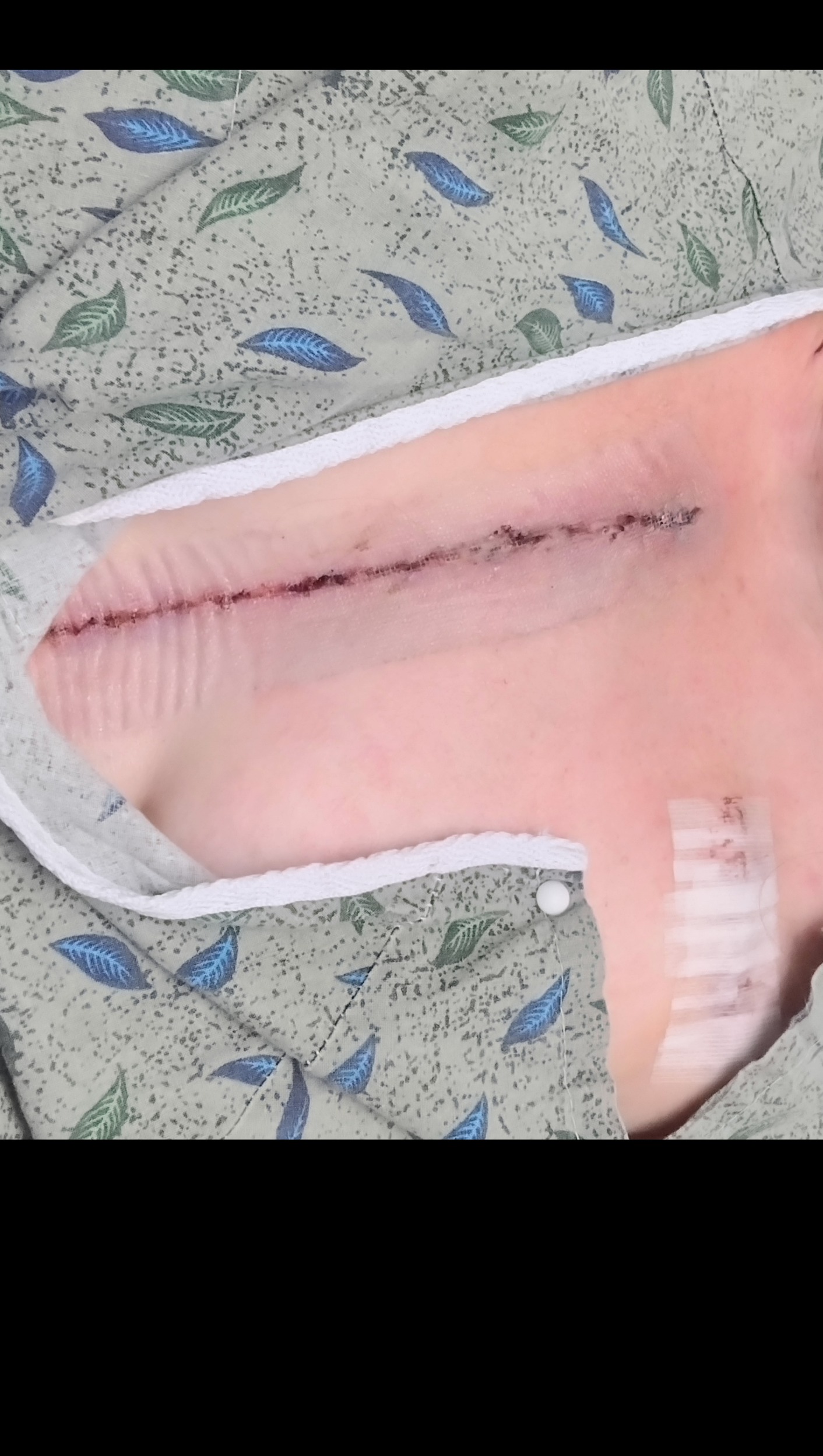 Fundraiser by Shara Matt Support Shara's Recovery from OpenHeart Surgery