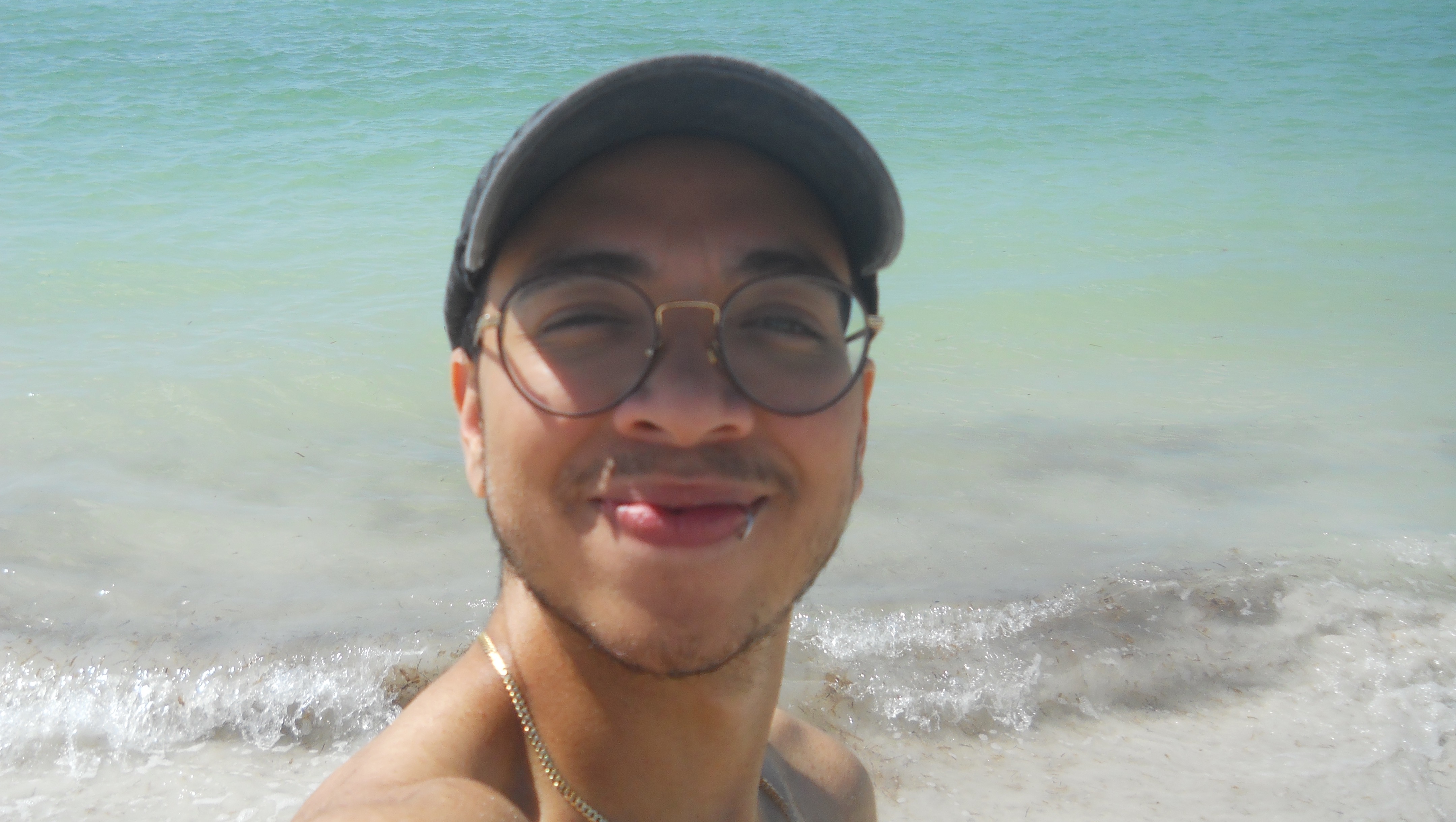 Make Casey's Dream of Top Surgery Real photo
