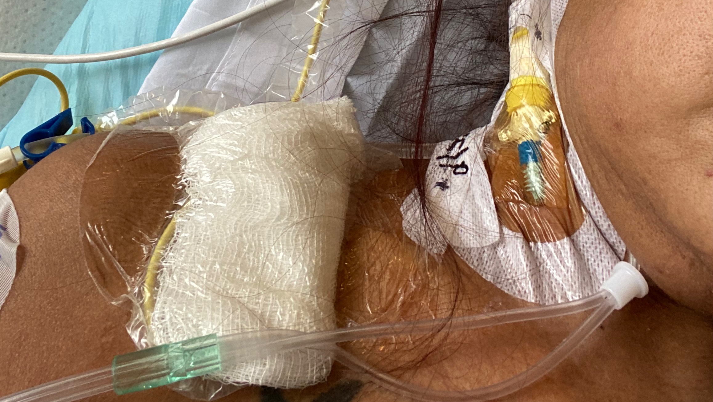 Support Alexa's Healing Journey photo