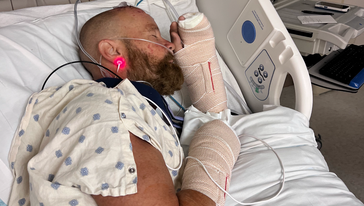 Fundraiser by Tom Bell Support Bert Bell's Recovery After Accident