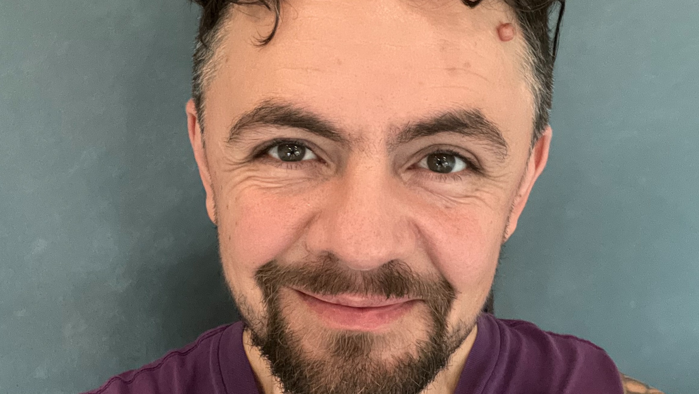 Lamia’s Trans Launch Pad: Top Surgery & Path to Stability photo