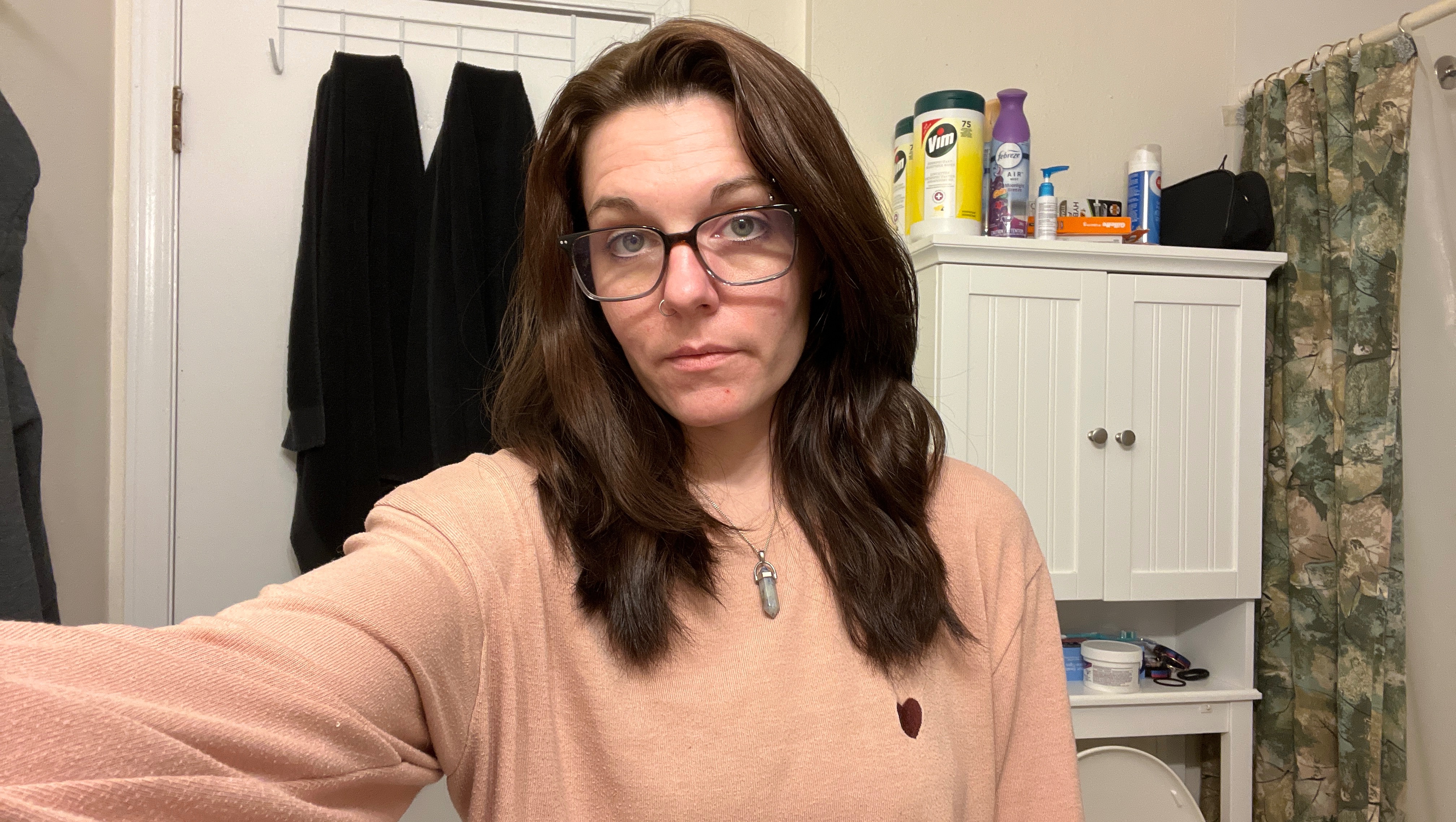 Breast augmentation and correction. photo