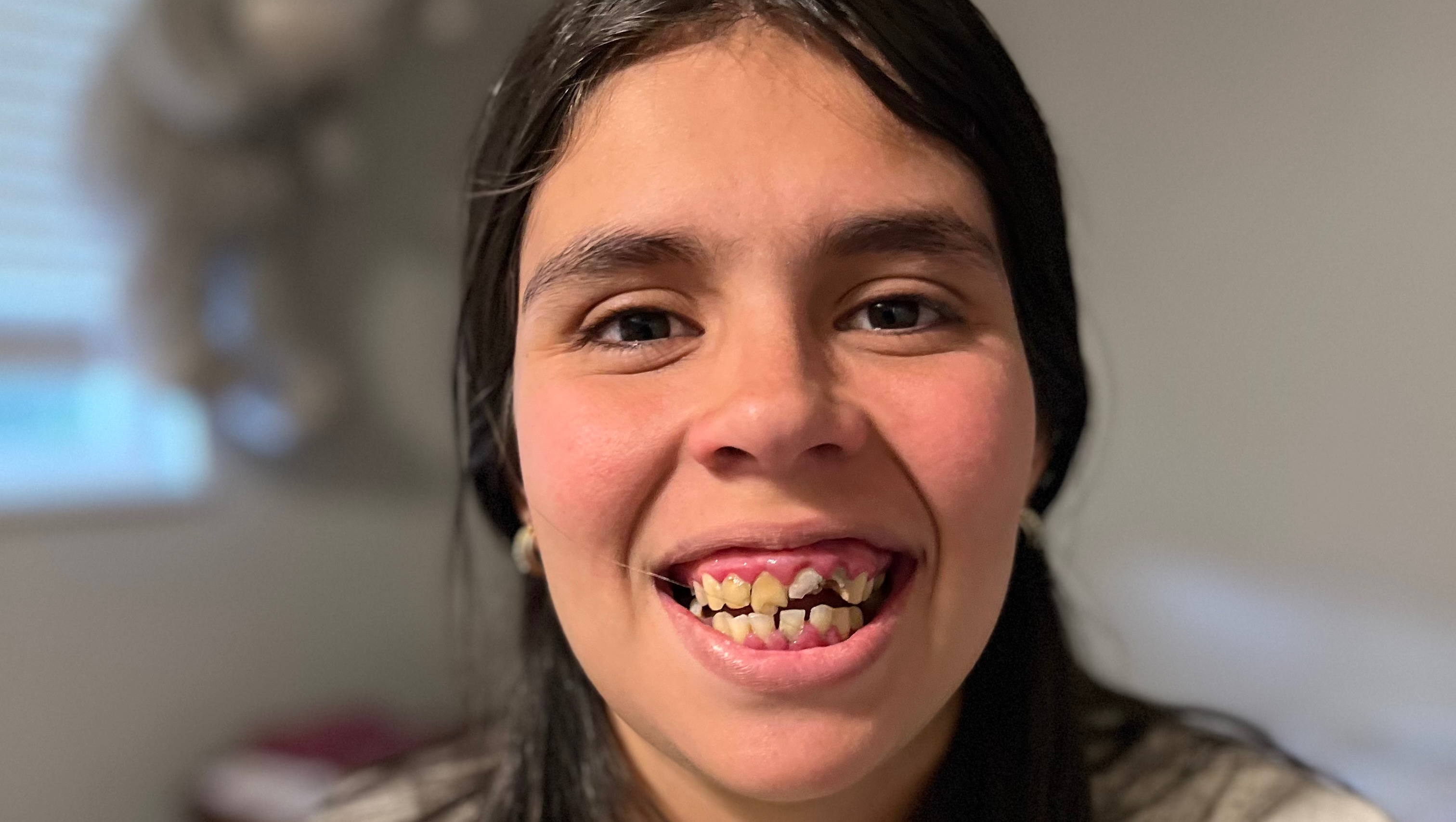 Support Maria's Journey to a Pain-Free Smile photo