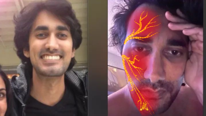 Support Rishi's Battle of Chronic Nerve Pain, Trig Neuralgia