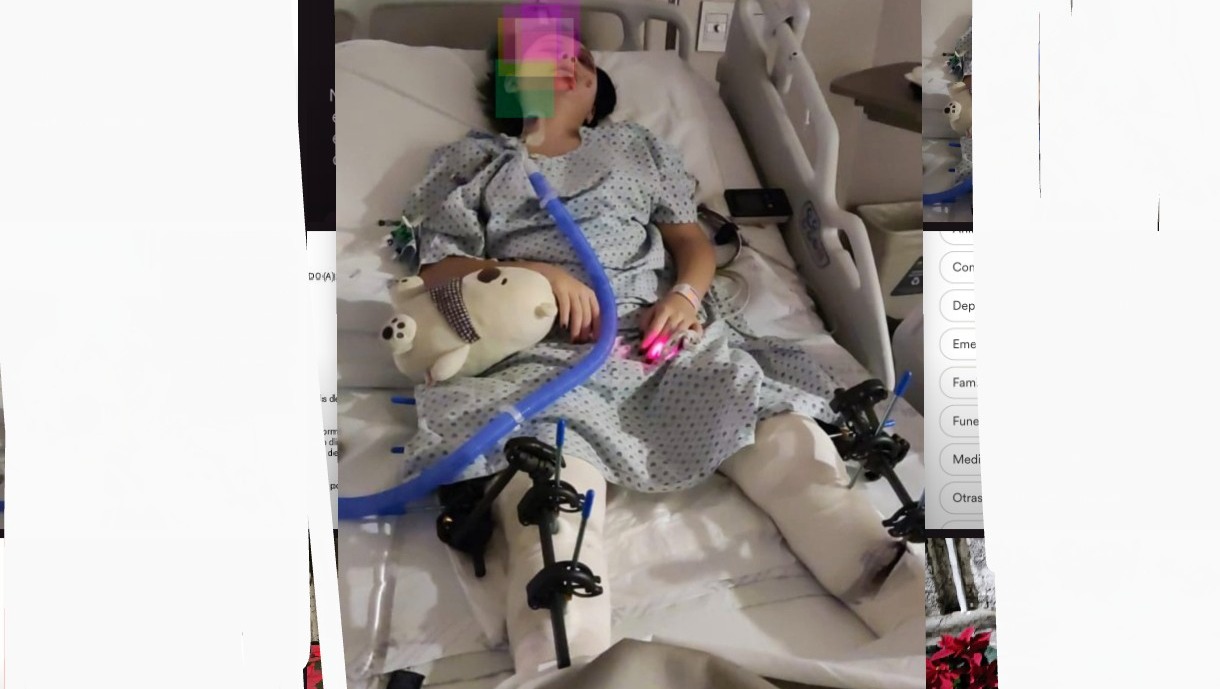 APOYEMOS A XIMENA PARA VOLVER A CAMINAR A SUS 15 AÑOS. pinned link photo