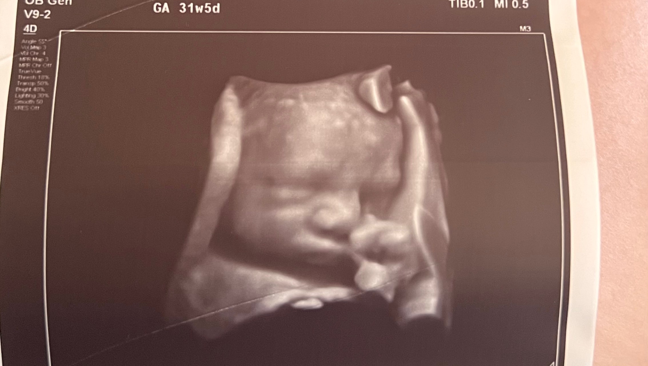 Support Chelsey and Baby Oliver's Medical Journey photo