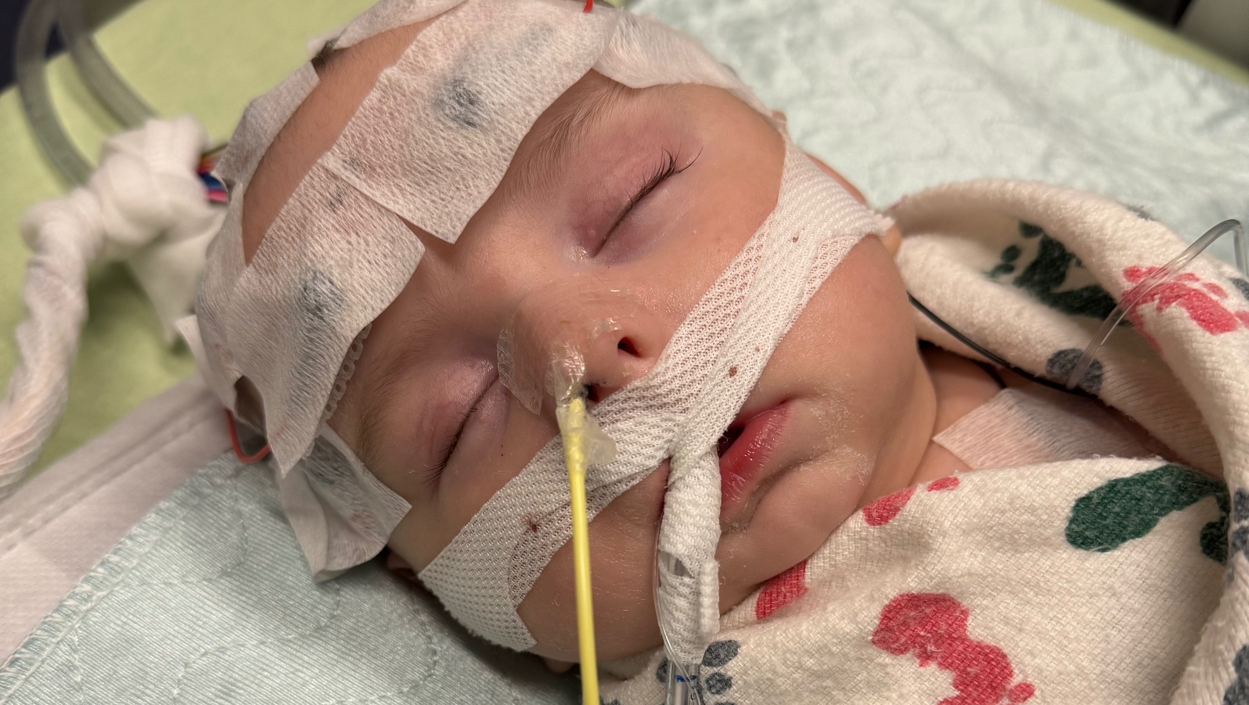 Help Baby Aspen Battle Meningitis photo