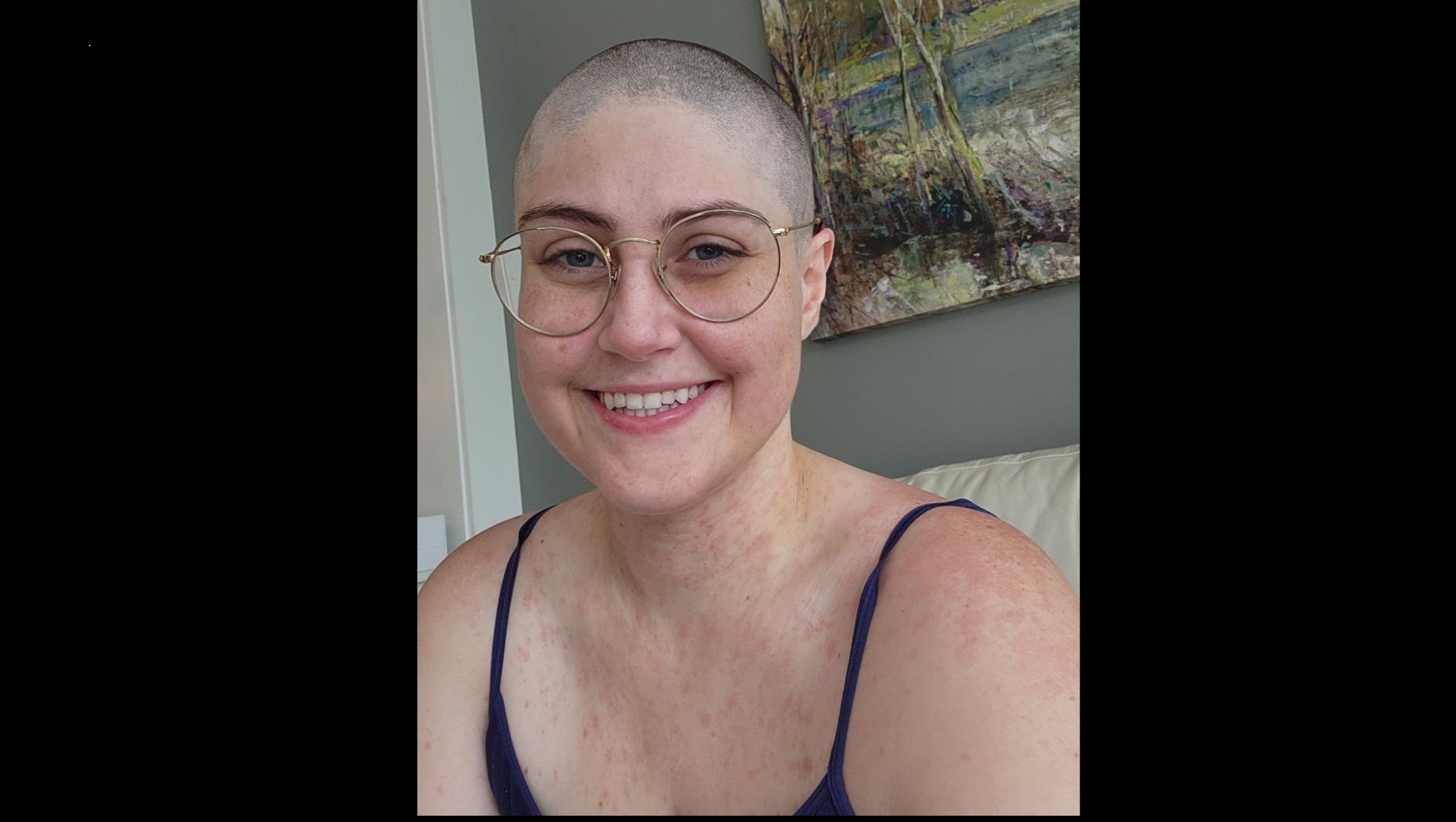 Help Elizabeth Burnett in Her Fight Against Leukemia photo