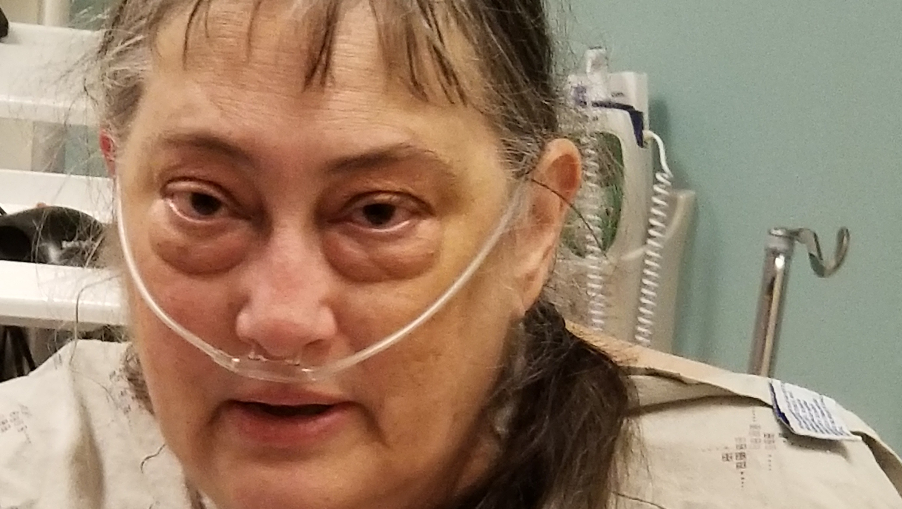 Heather & Kaity need funds go to Mayo Clinic and Barrow. photo