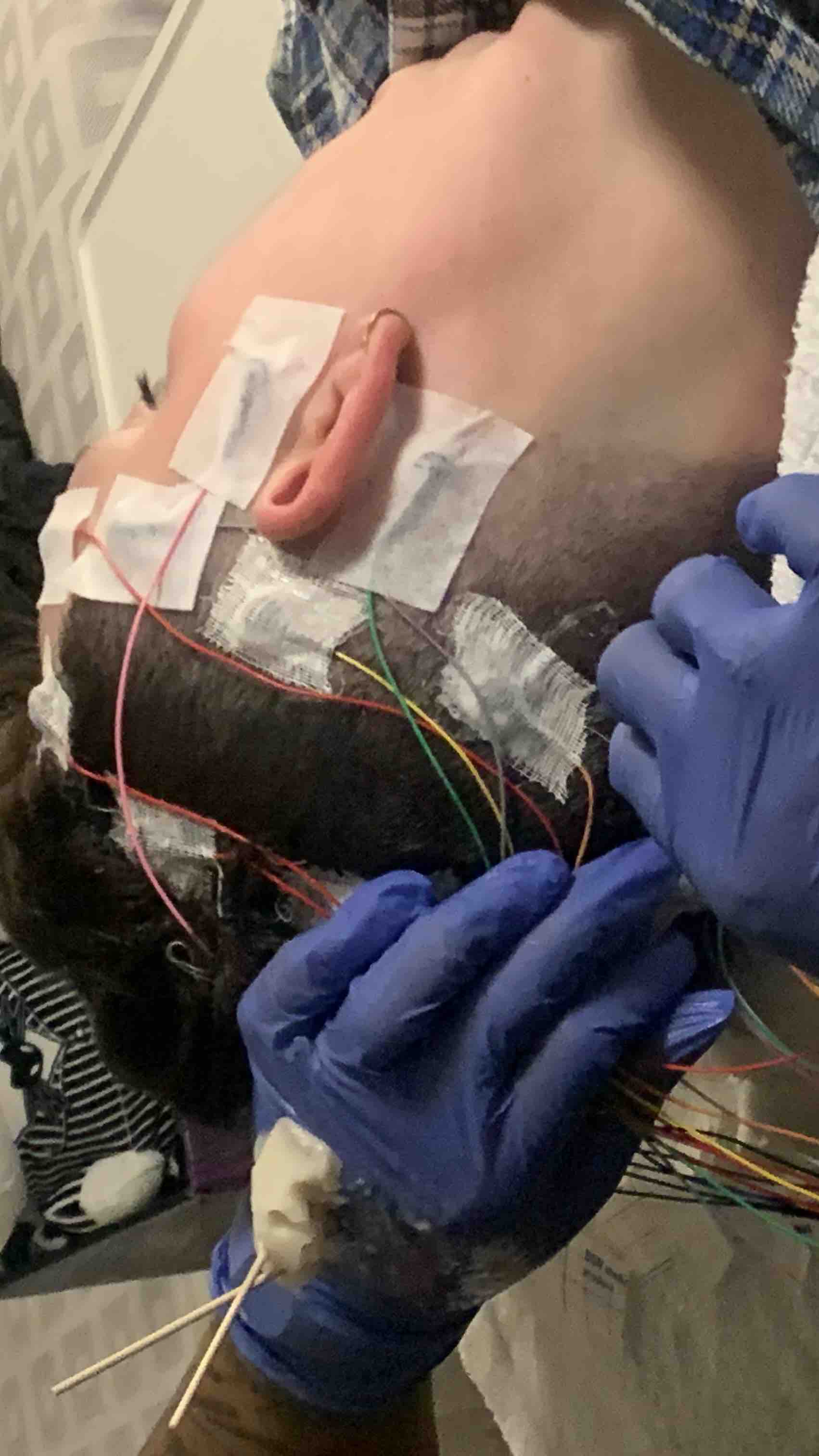 Cnn Anchor'S Health Crisis: The Brain Tumor Battle - 4xe4p54