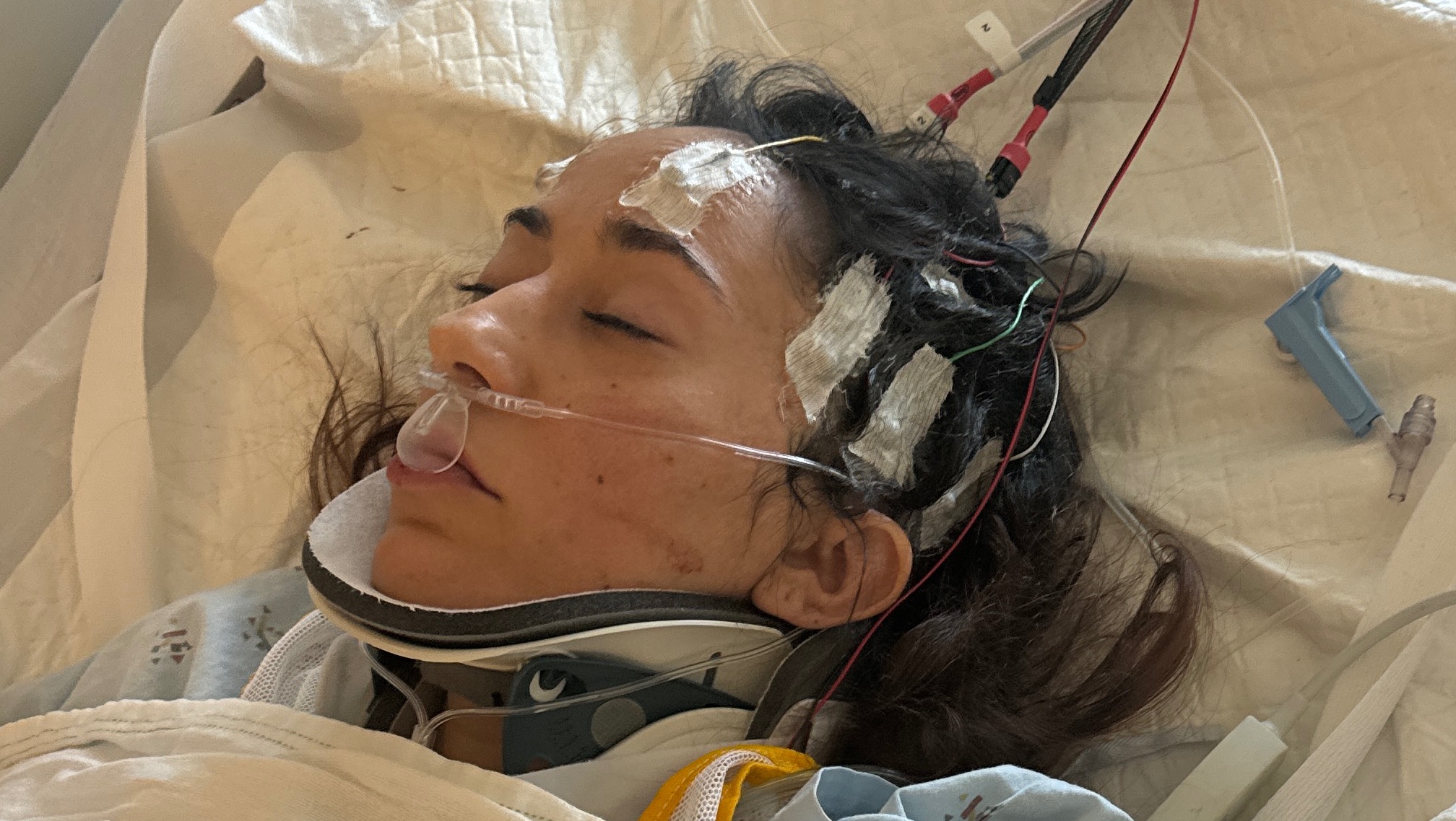 JOHANNA RODRIGUEZ MEDICAL RECOVERY: DRUNK DRIVER HIT AND RUN photo