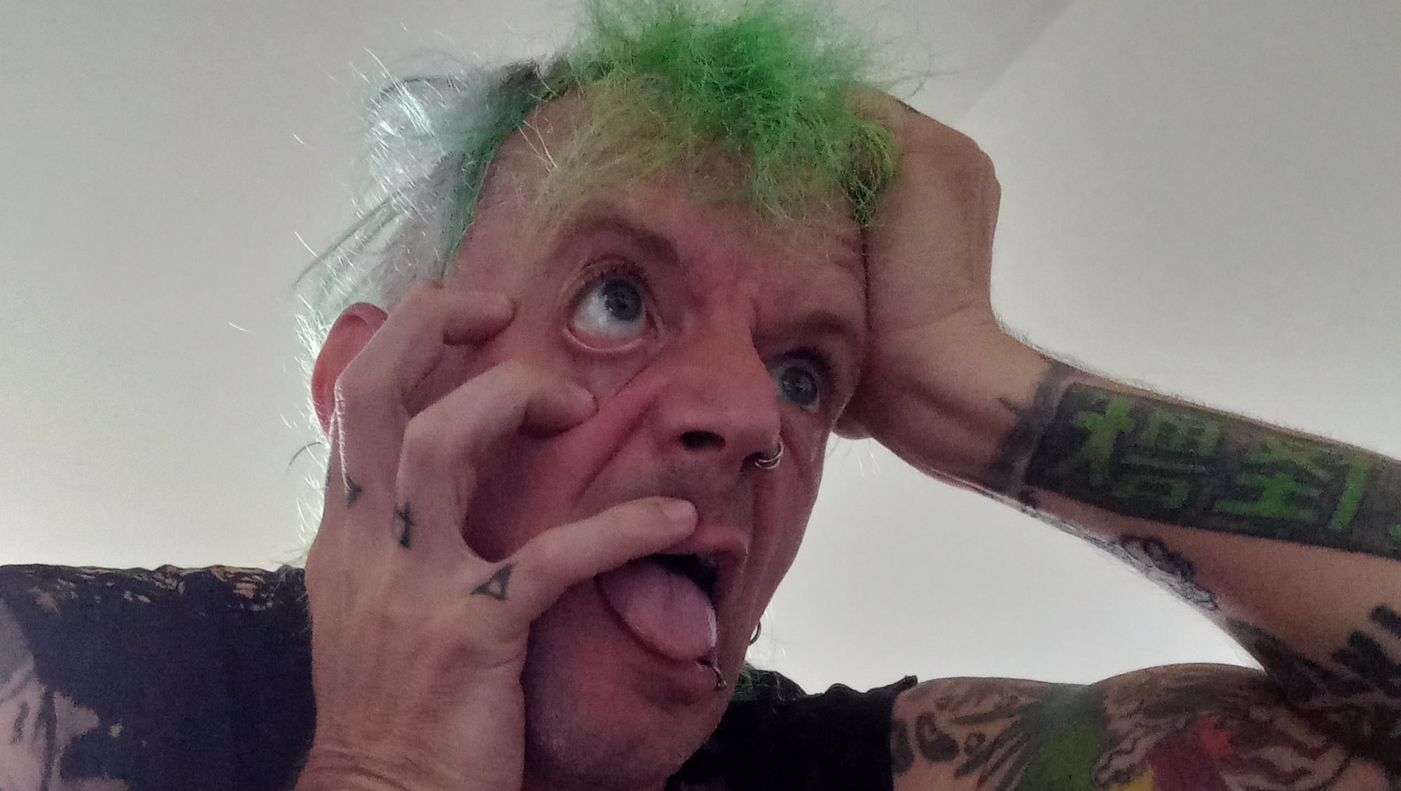 Help mij om mijn medische kosten te betalen photo