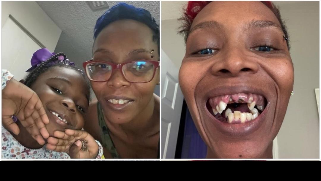 Erika needs this dental surgery to get back on her feet! photo