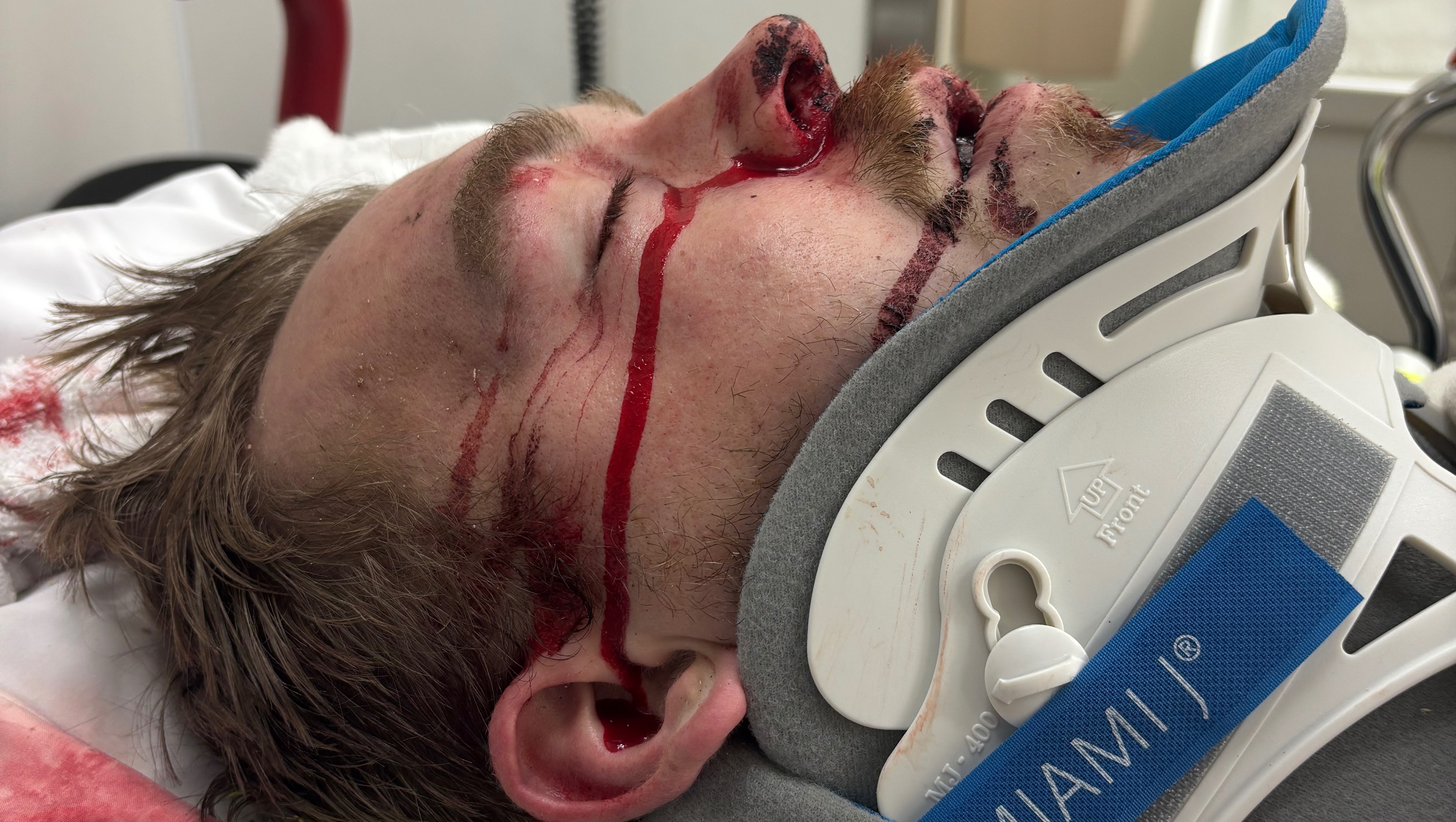 Support Dakota Pay's Critical Recovery Journey photo