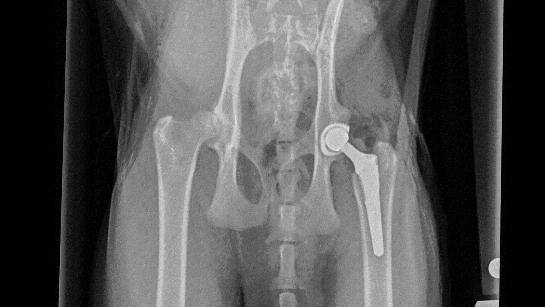 Help Frank Walk Again: Emergency Surgery Fundraiser photo