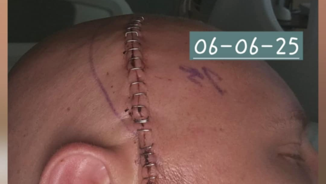 Brain cancer and a family to provide for. photo