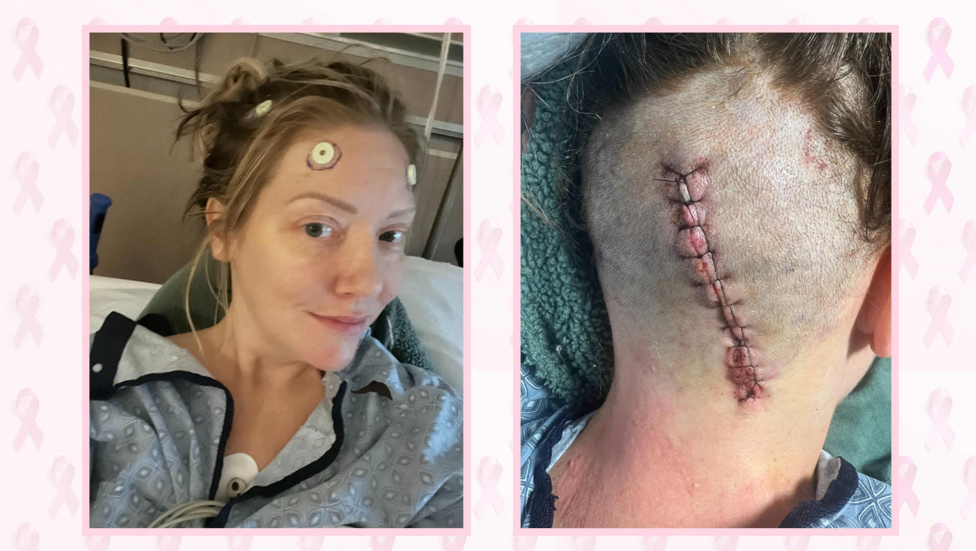 Support Lis' Healing Journey with Cancer photo