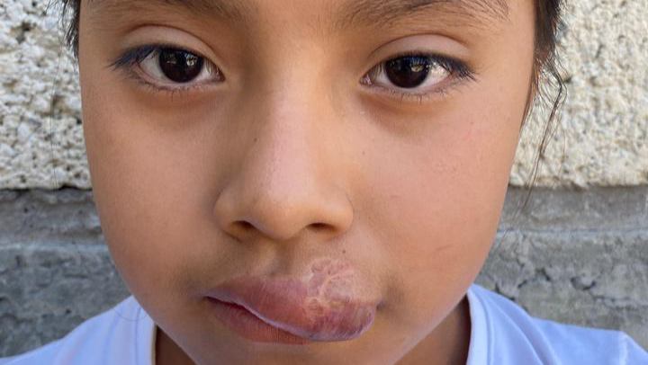 Help Valeria Smile Again! photo