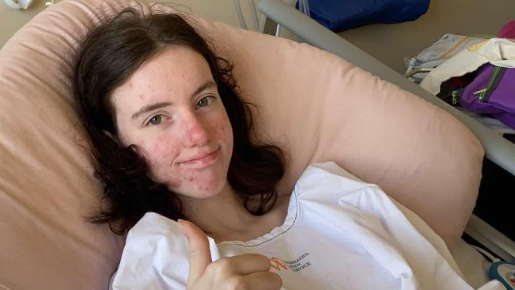 Shanae  Fox   3rd degree burns. pinned link photo