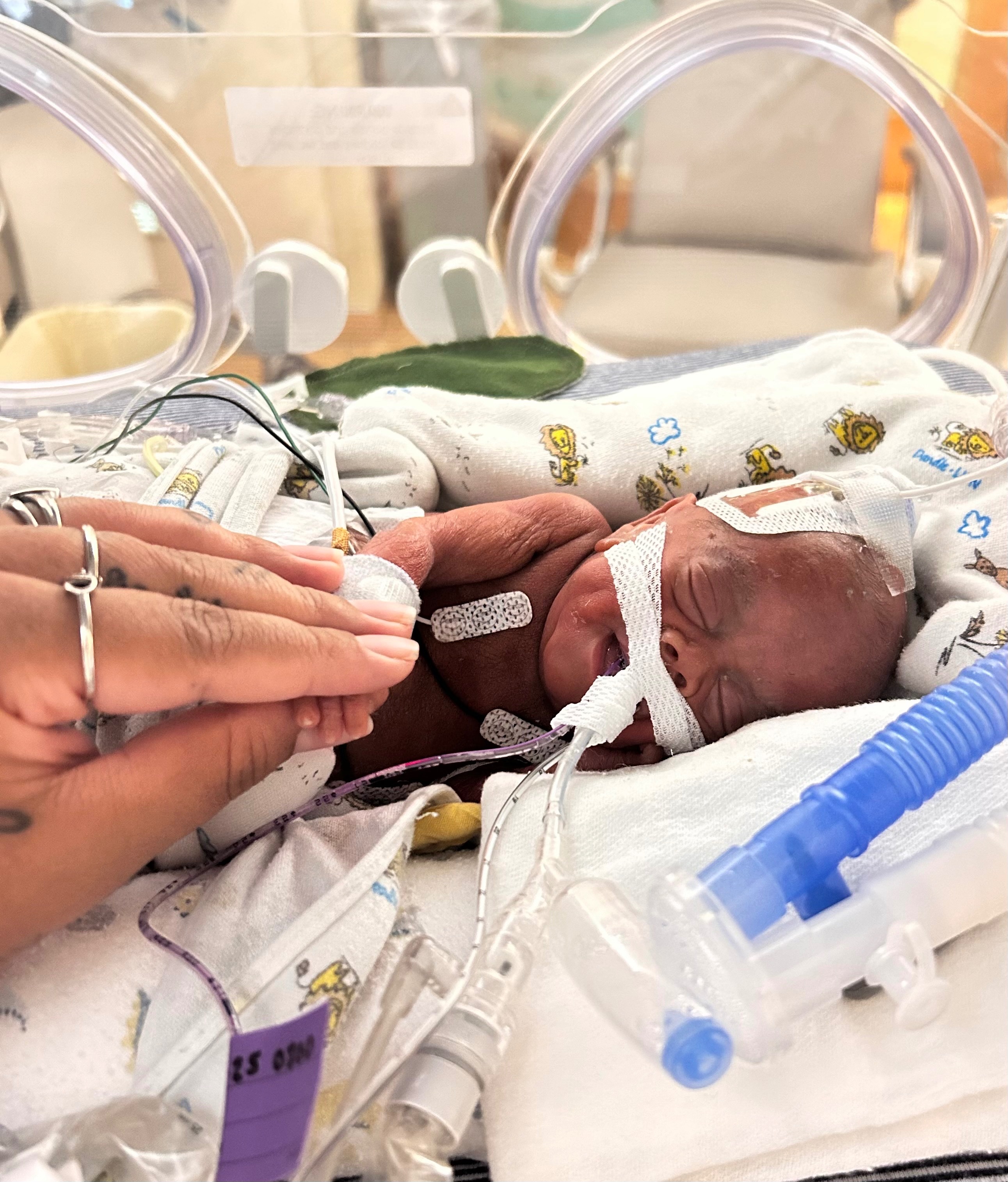 Malcom family NICU journey campaign photo, 2 of 6