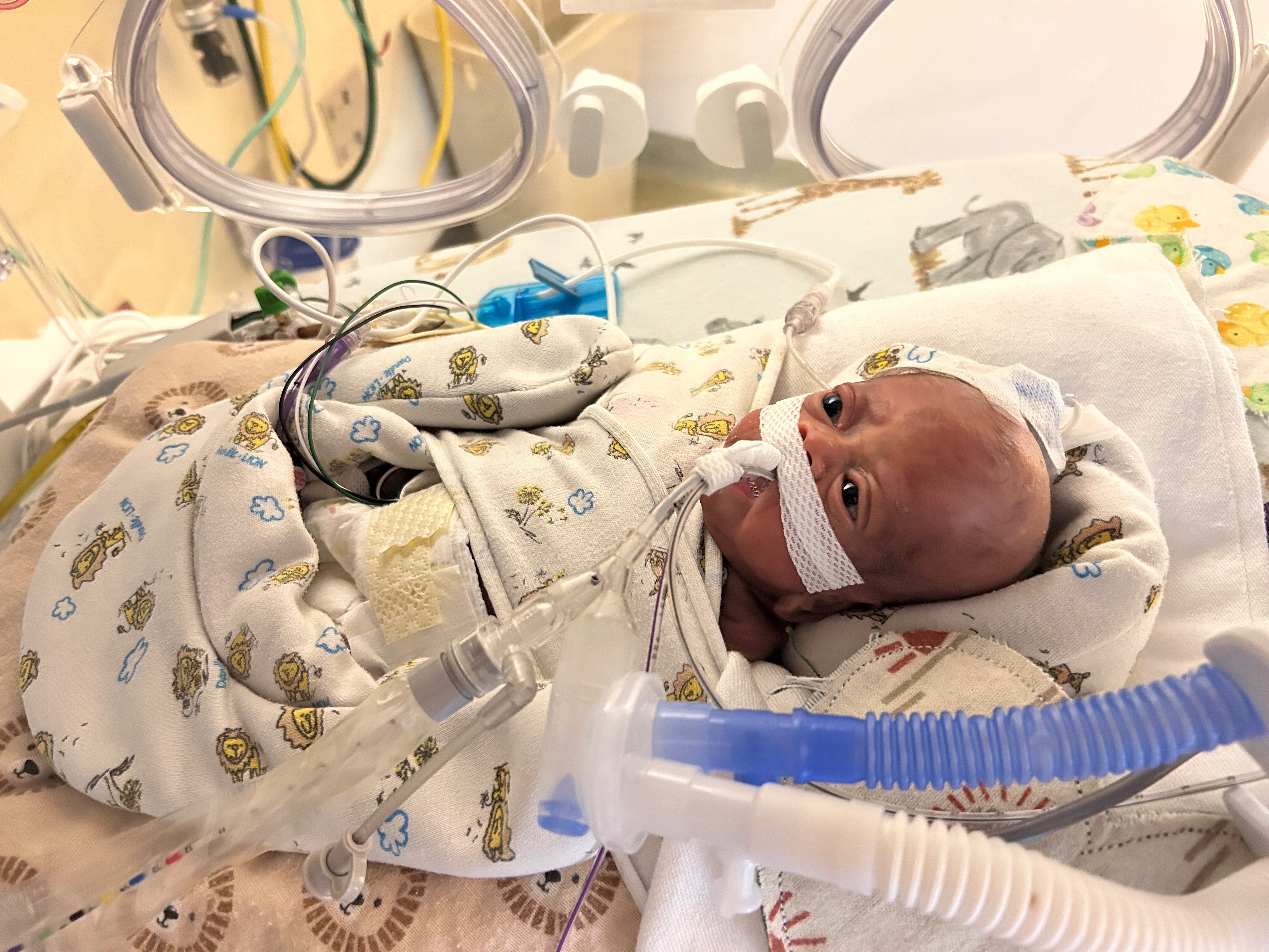 Malcom family NICU journey campaign photo, 4 of 6