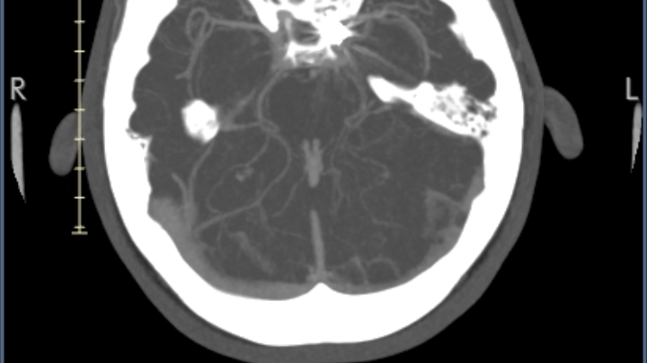 Support Katelyn's Journey to proving doctors wrong photo