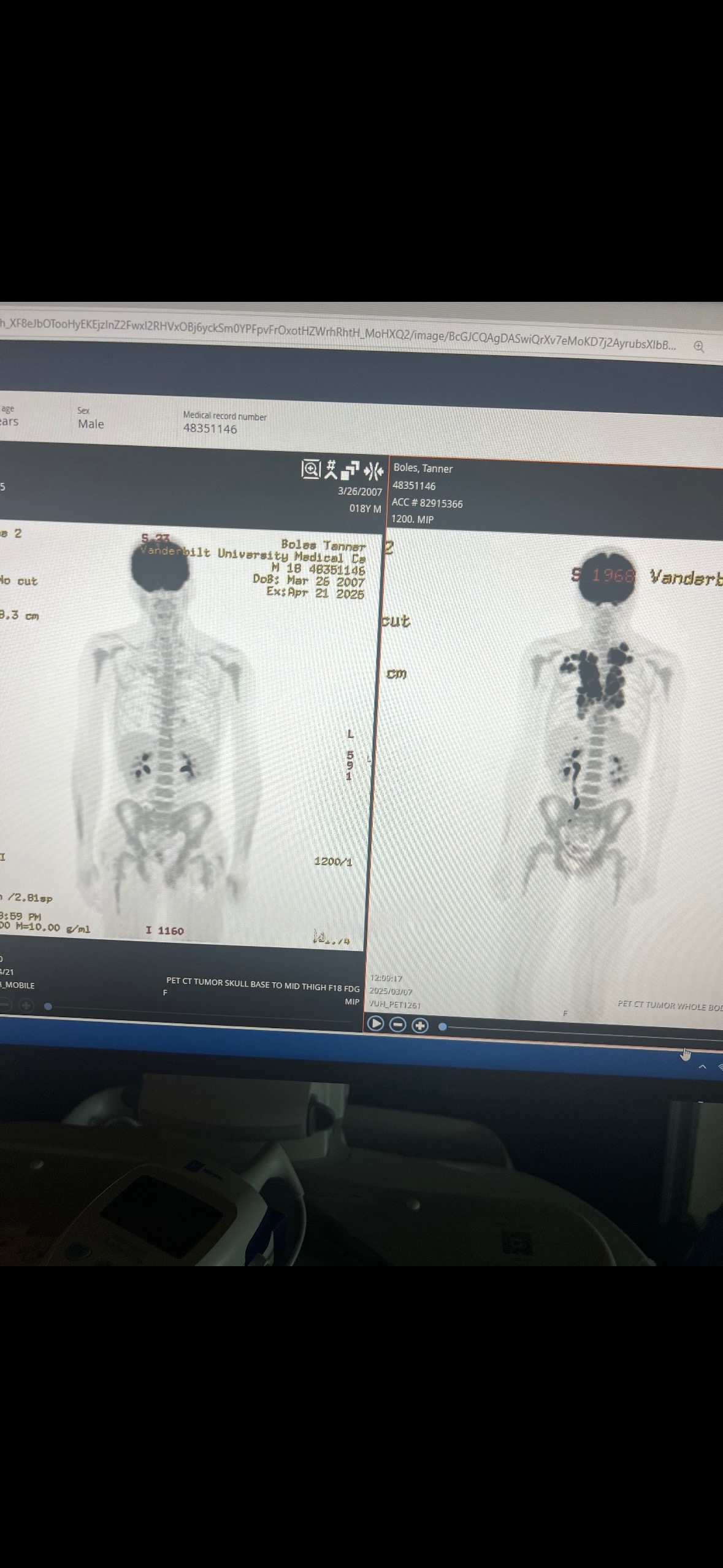 Help Tanner get to Ohio for radiation campaign photo, 2 of 7