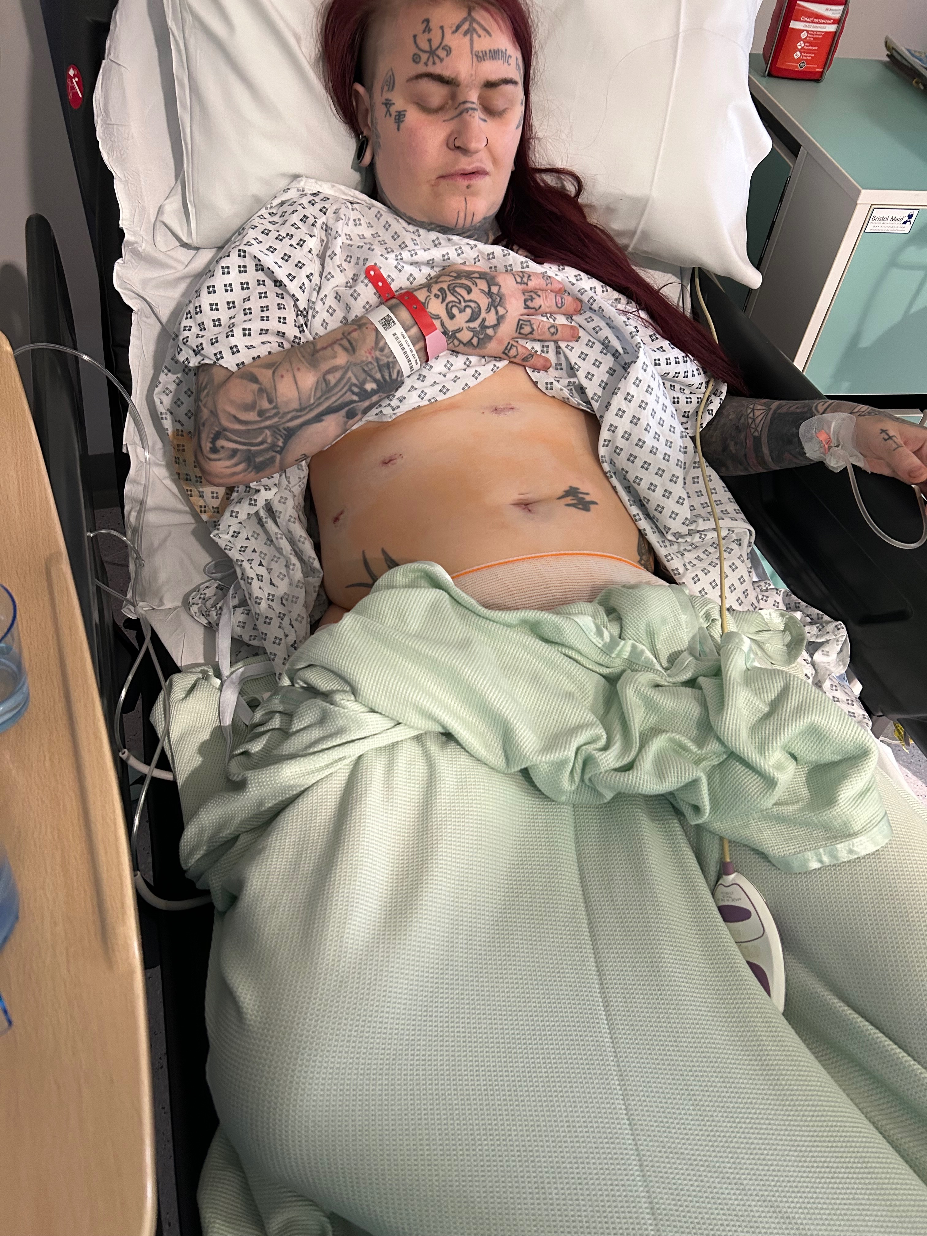 Donate to help a woman facing multiple intensive surgeries campaign photo, 6 of 8