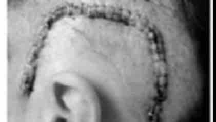 La bataille d’Isabelle pinned link photo