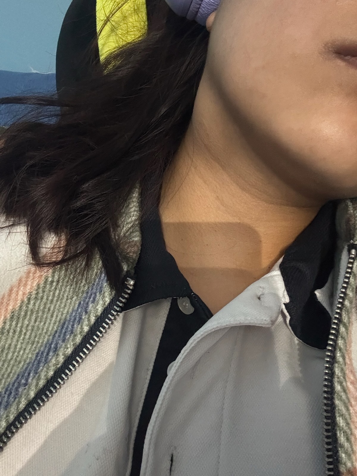 Help Simran Fight a Rare Paraganglioma Neck Tumor” campaign photo, 4 of 6