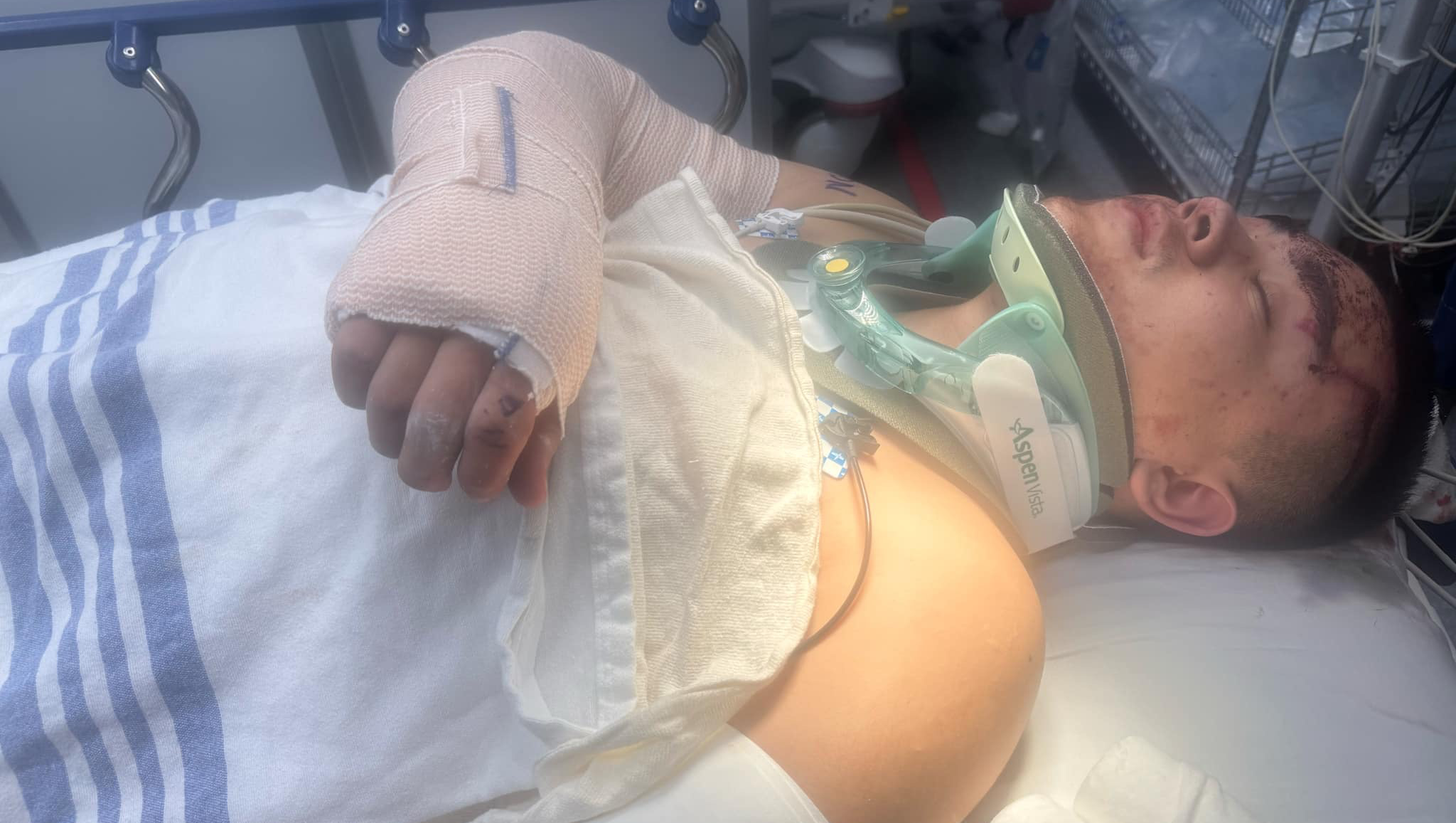 Help Ana's Cousin in His Recovery Journey photo