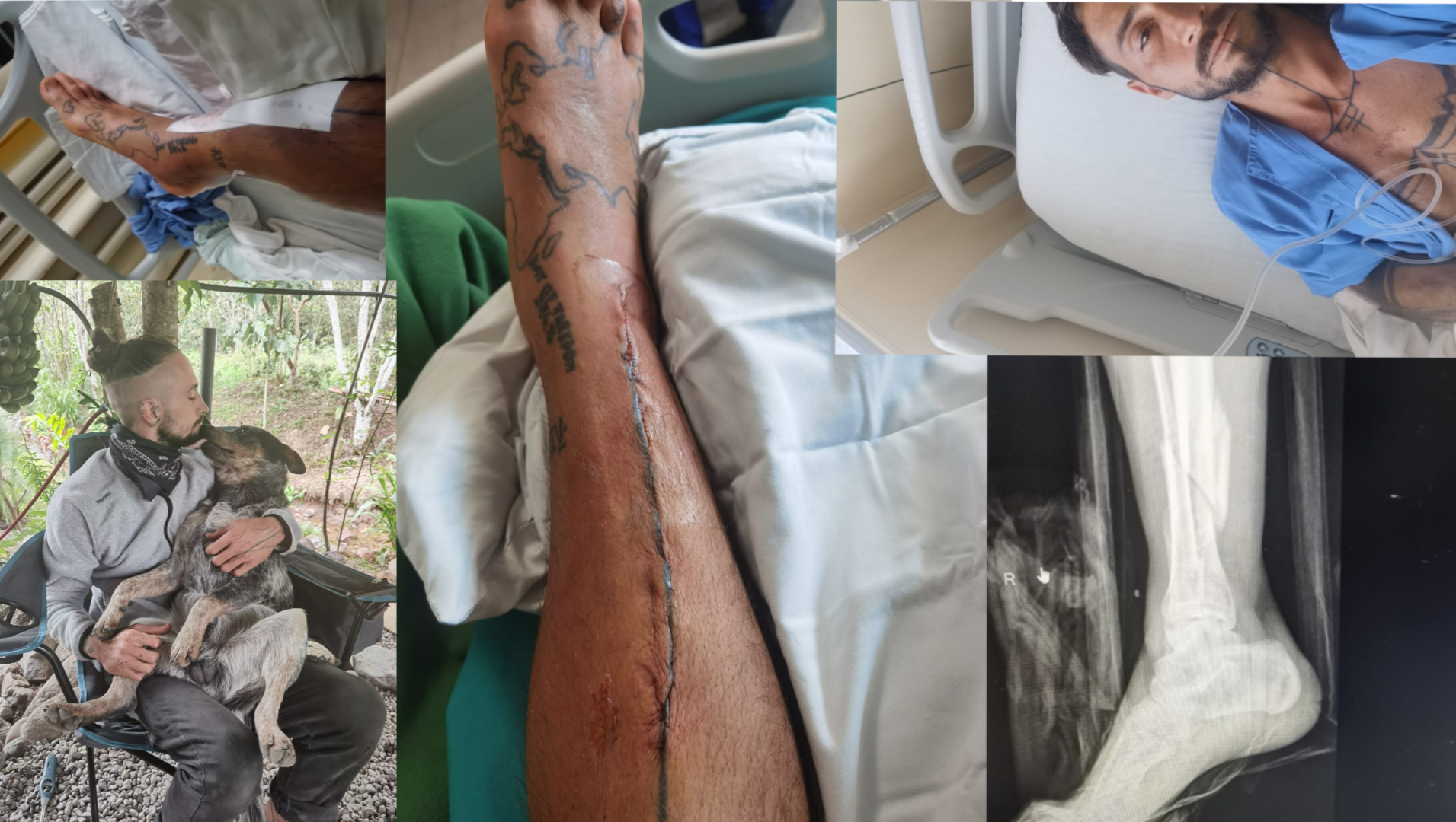 "Save Jörg Politz – Emergency After a Severe Traffic Crash" photo