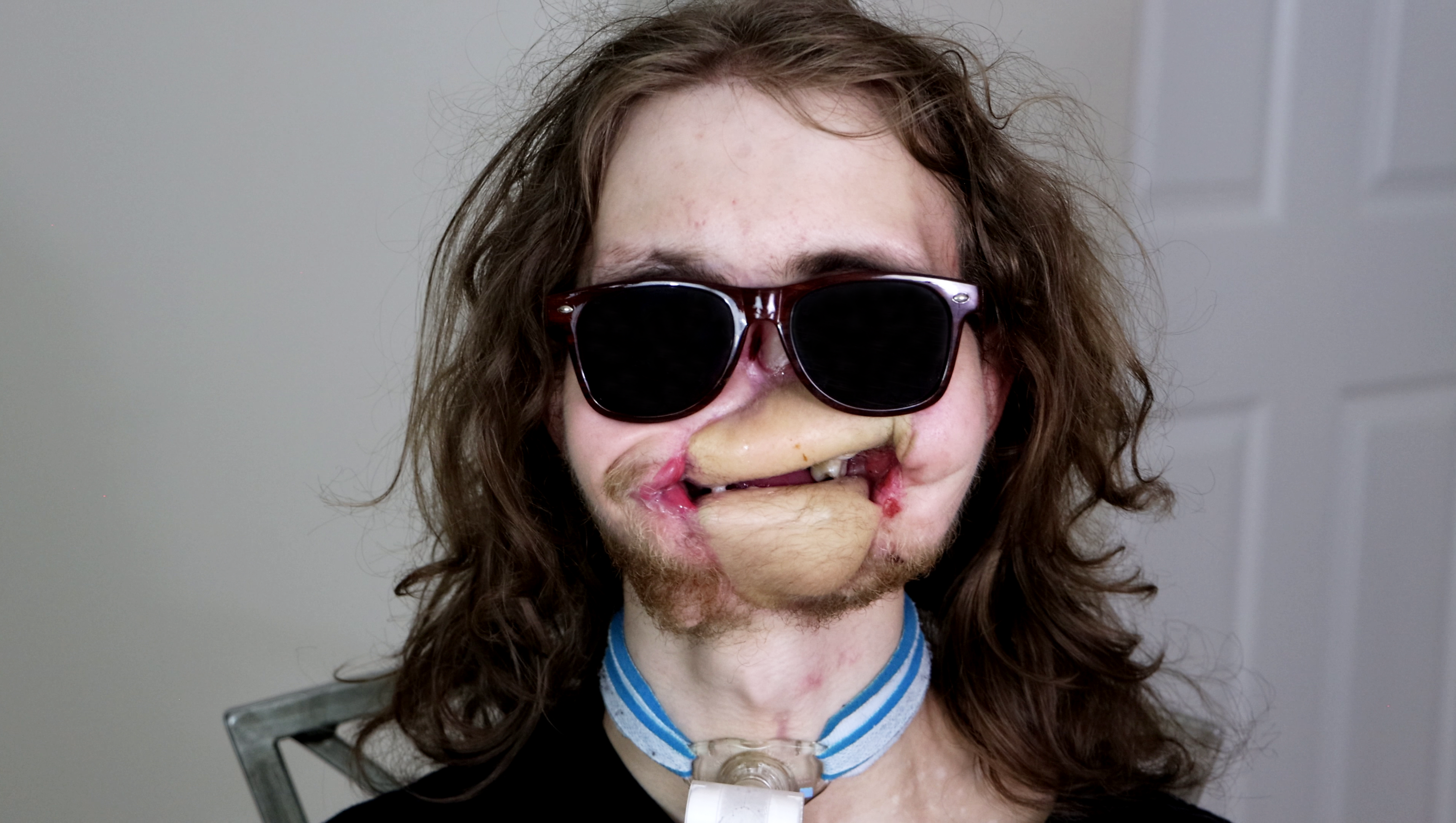 Help Triston Regain Independence photo