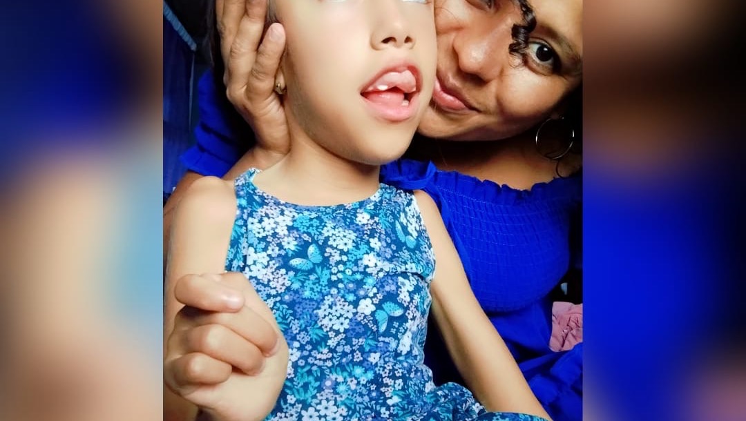 ayuda a fernanda ella tiene hidrocefalia pinned link photo