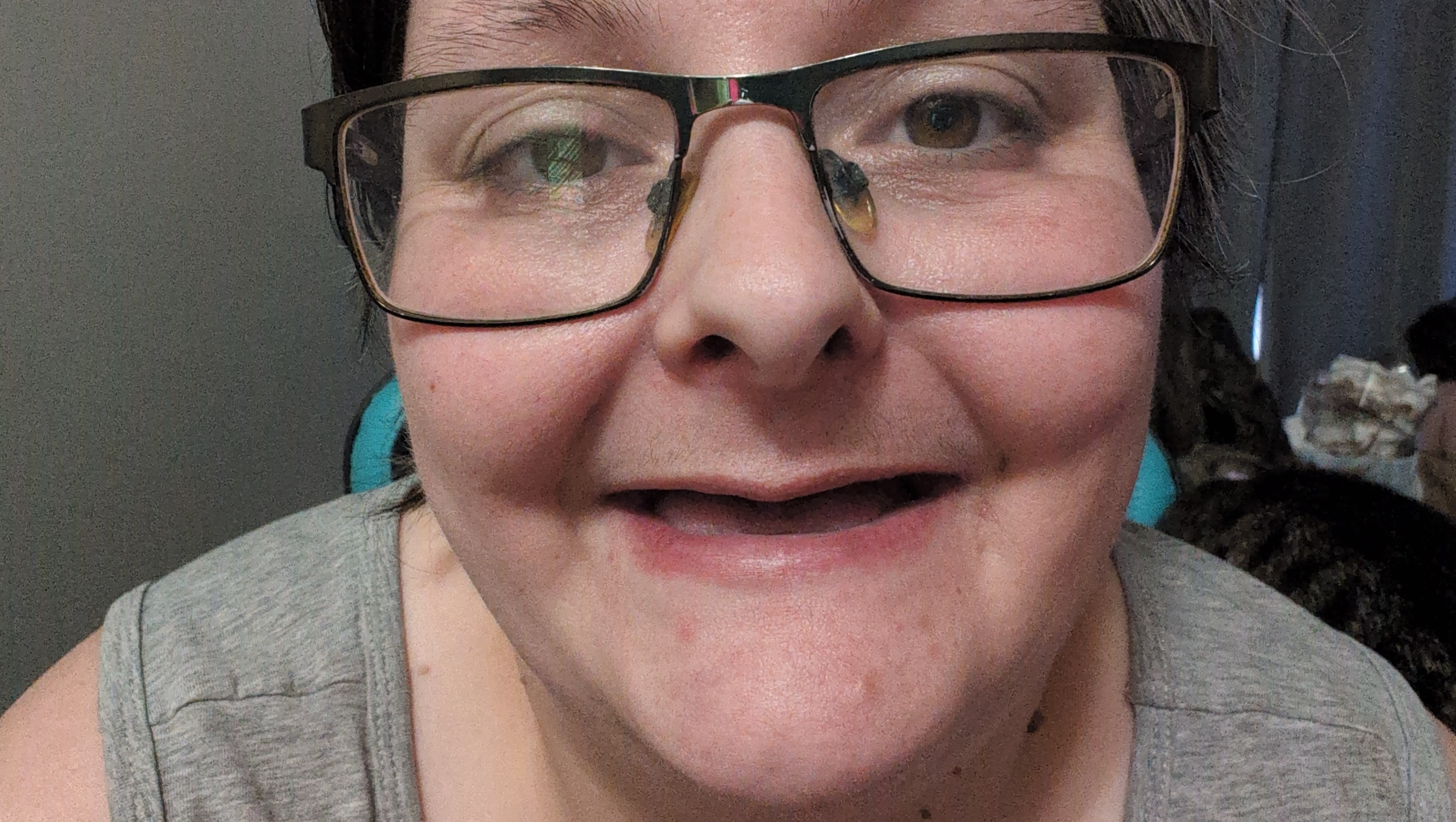 Sarah getting her dentures. To feel teeth again! pinned link photo