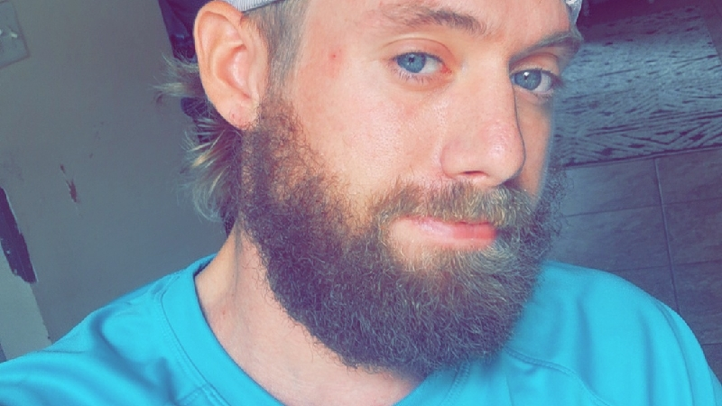 Fundraiser by Adam Rittenhouse : Help Me Heal: Chainsaw Accident Recovery