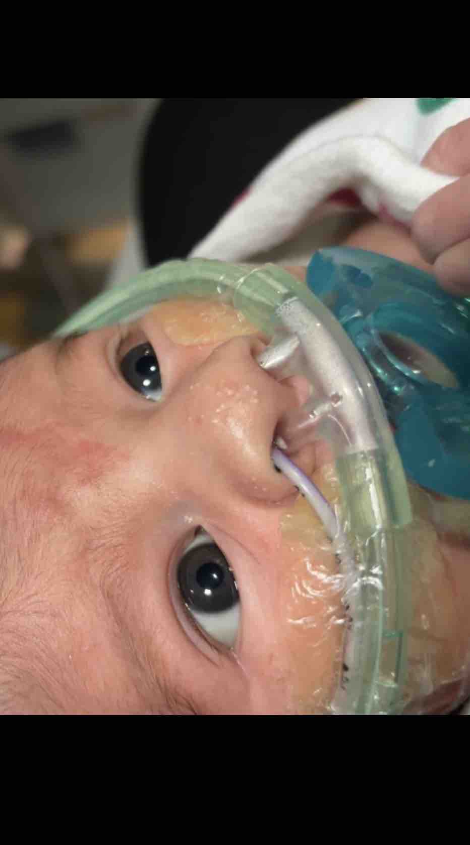 Join Us in Supporting Baby Arsiah's Recovery photo